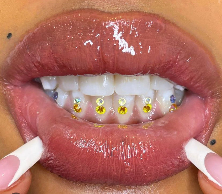 Golden Yellow Gems